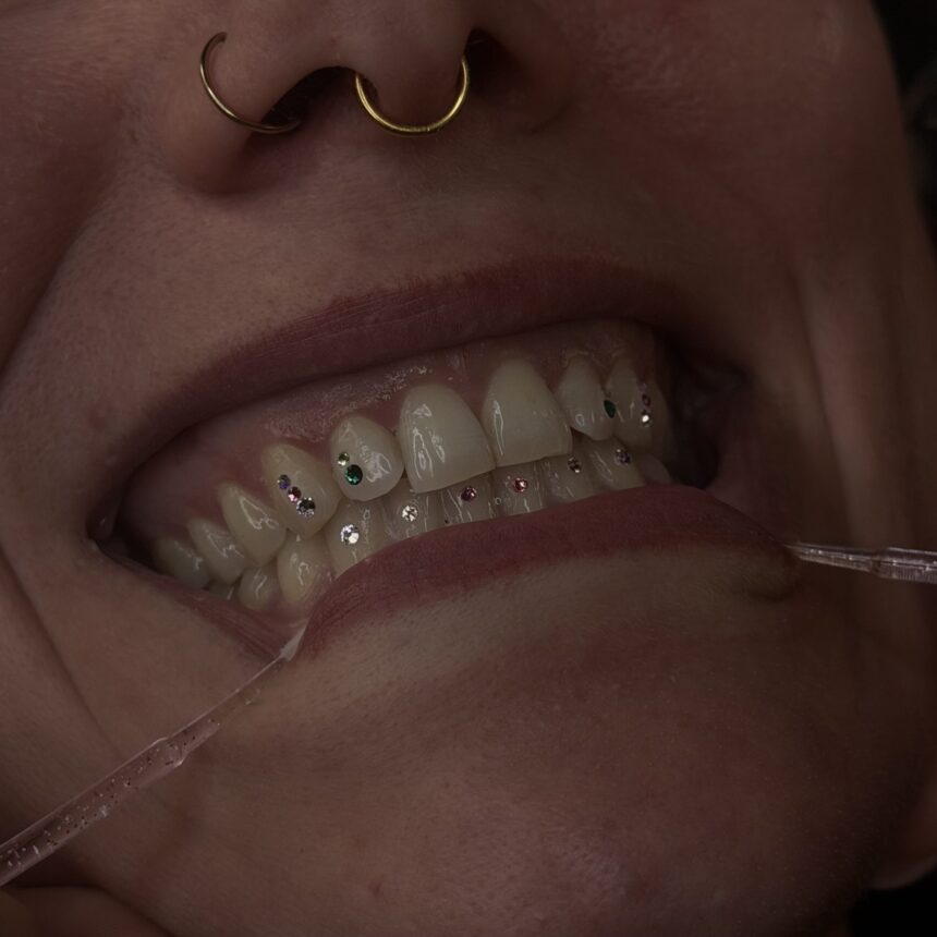 Tooth gems hos House of Body Art i Viborg