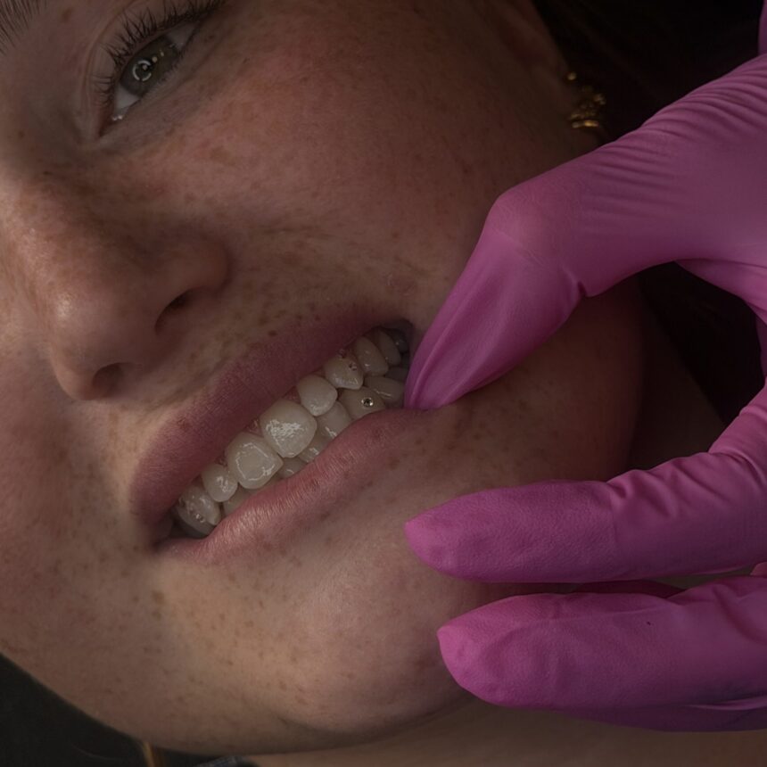 Tooth gems hos House of Body Art i Viborg