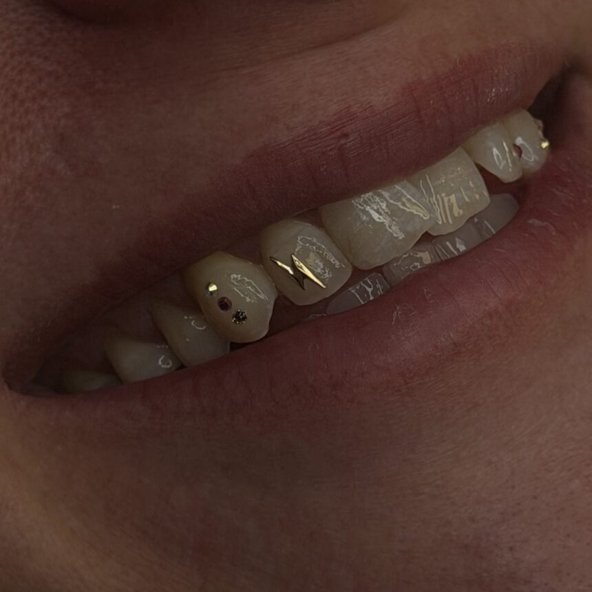 Tooth gems hos House of Body Art i Viborg