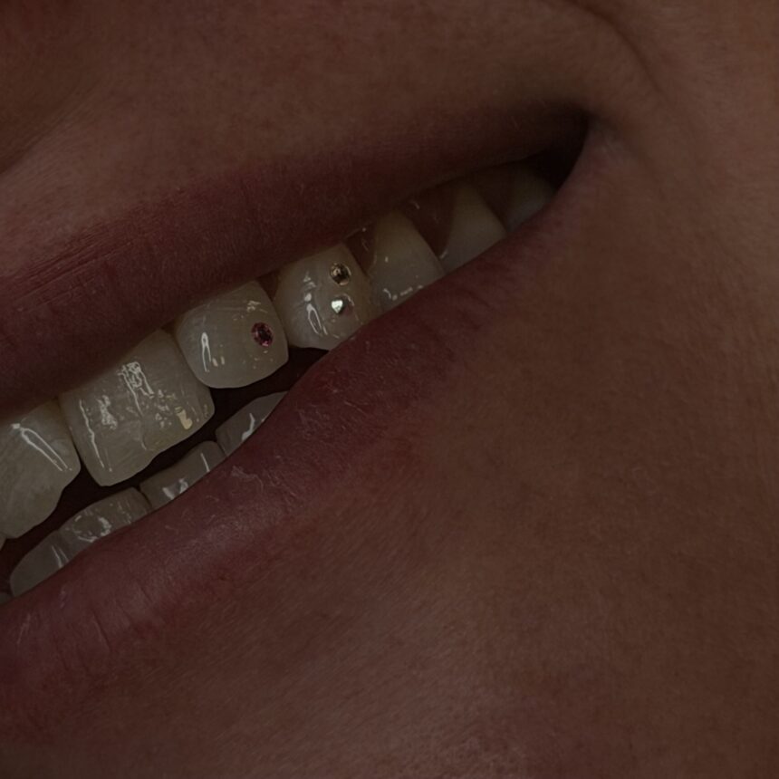Tooth gems hos House of Body Art i Viborg