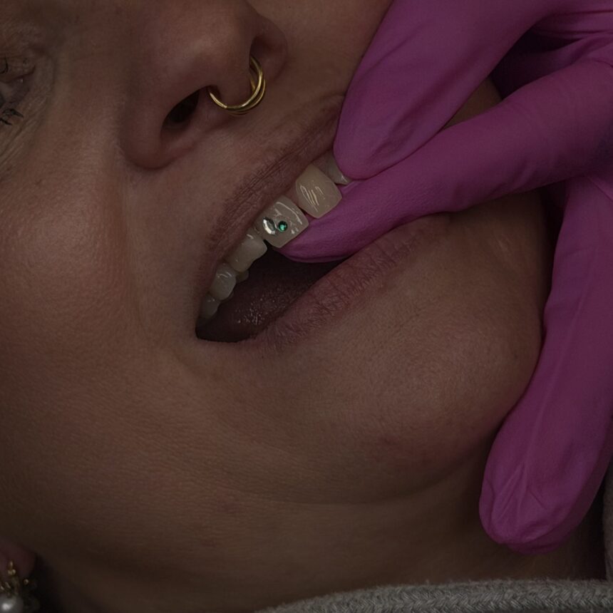 Tooth gems hos House of Body Art i Viborg