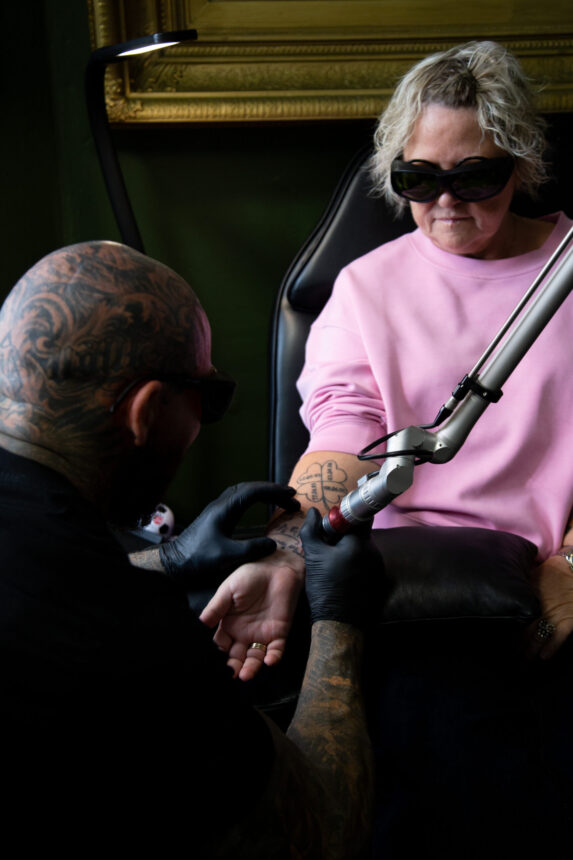 Laserfjernelse af tatovering hos House of Body Art i Viborg